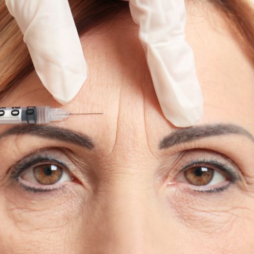 Tratamiento para eliminar las arrugas del entrecejo con botox en la clínica de medicina estética IME en MAdrid