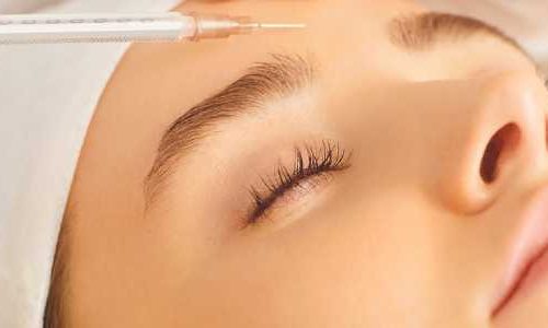Eliminar arrugas con botox clínica medicina estética en Madrid