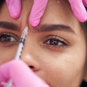 quitar arrugas entrecejo en la clínica de medicina de estética IME en Madrid