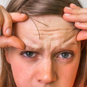 quitar arrugas frente con botox