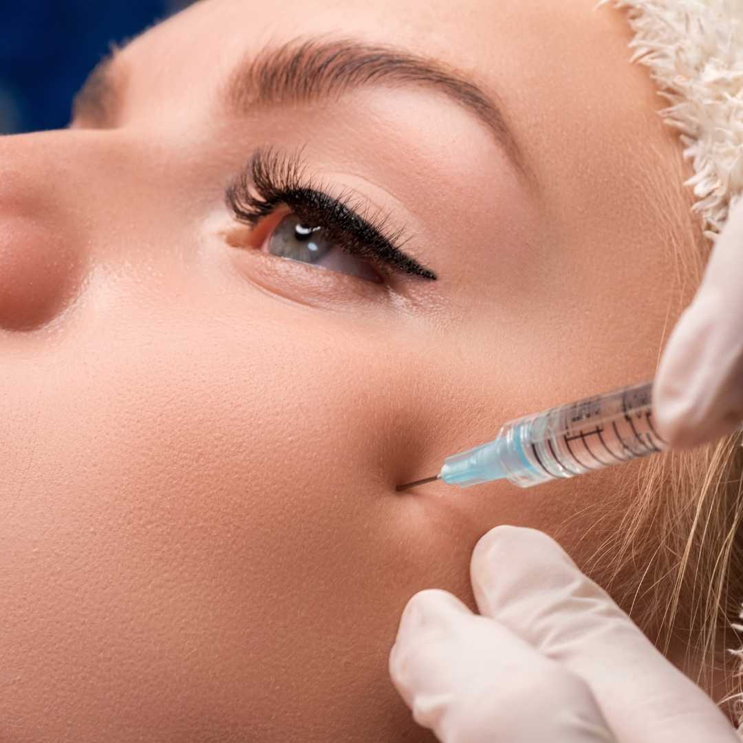 Razones por las que realizar el Tratamiento de pómulos con ácido hialurónico en la clínica de medicina estética en Madrid IME