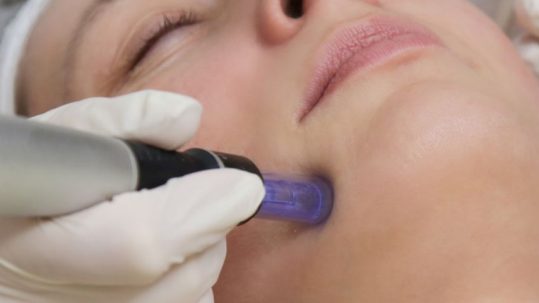 enzimas recombinantes facial IME