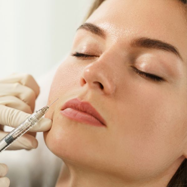 polinucleotidos Madrid tratamiento en en la mejor clínica de medicina estetica de Madrid